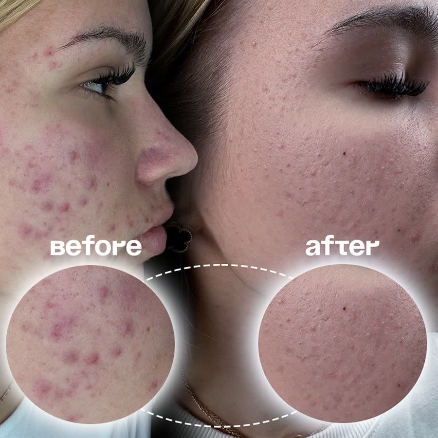 Tratament facial – piele înainte și după, Salon Venus, Cartierul Arhitecților